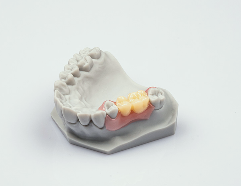 dental dental